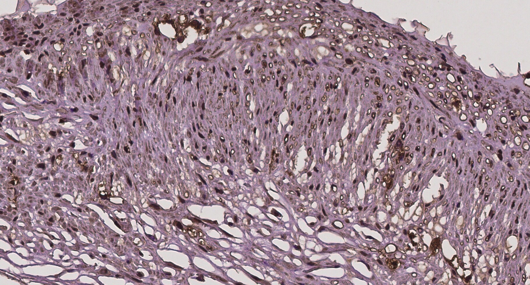 HMGB1/HMG-1 Antibody - BSA Free NB100-2322