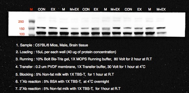 IRE1 alpha [p Ser724] Antibody - BSA Free NB100-2323