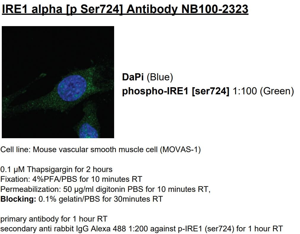 IRE1 alpha [p Ser724] Antibody - BSA Free NB100-2323