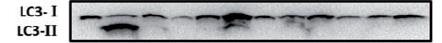 LC3A Antibody - BSA Free NB100-2331
