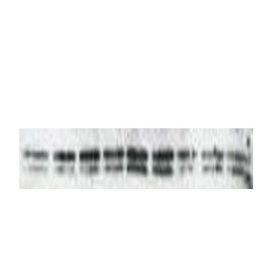LC3A Antibody - BSA Free NB100-2331