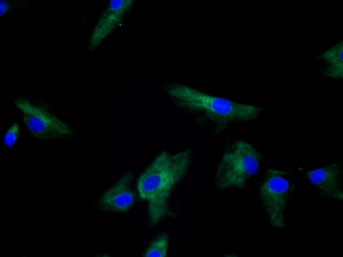 LOX Antibody - BSA Free NB100-2527