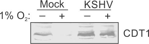 CDT1 Antibody - BSA Free NB100-2567