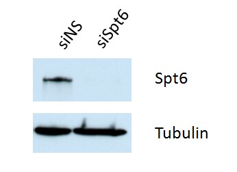 Spt6 Antibody NB100-2582