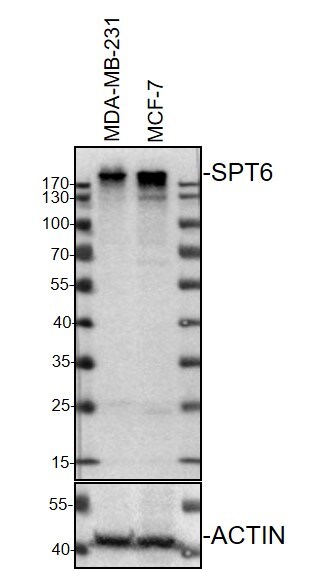 Spt6 Antibody NB100-2582