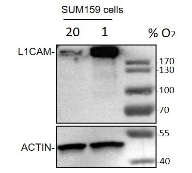 L1CAM Antibody (UJ127.11) - BSA Free NB100-2682