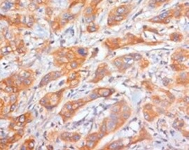 L1CAM Antibody (UJ127.11) - BSA Free NB100-2682