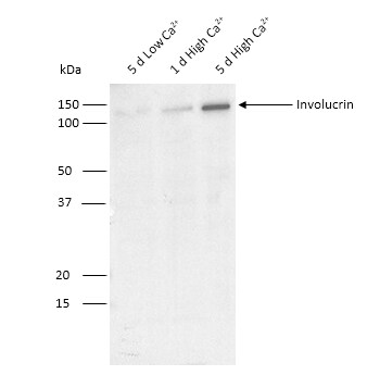 Involucrin Antibody (SY5) - BSA Free NB100-2727
