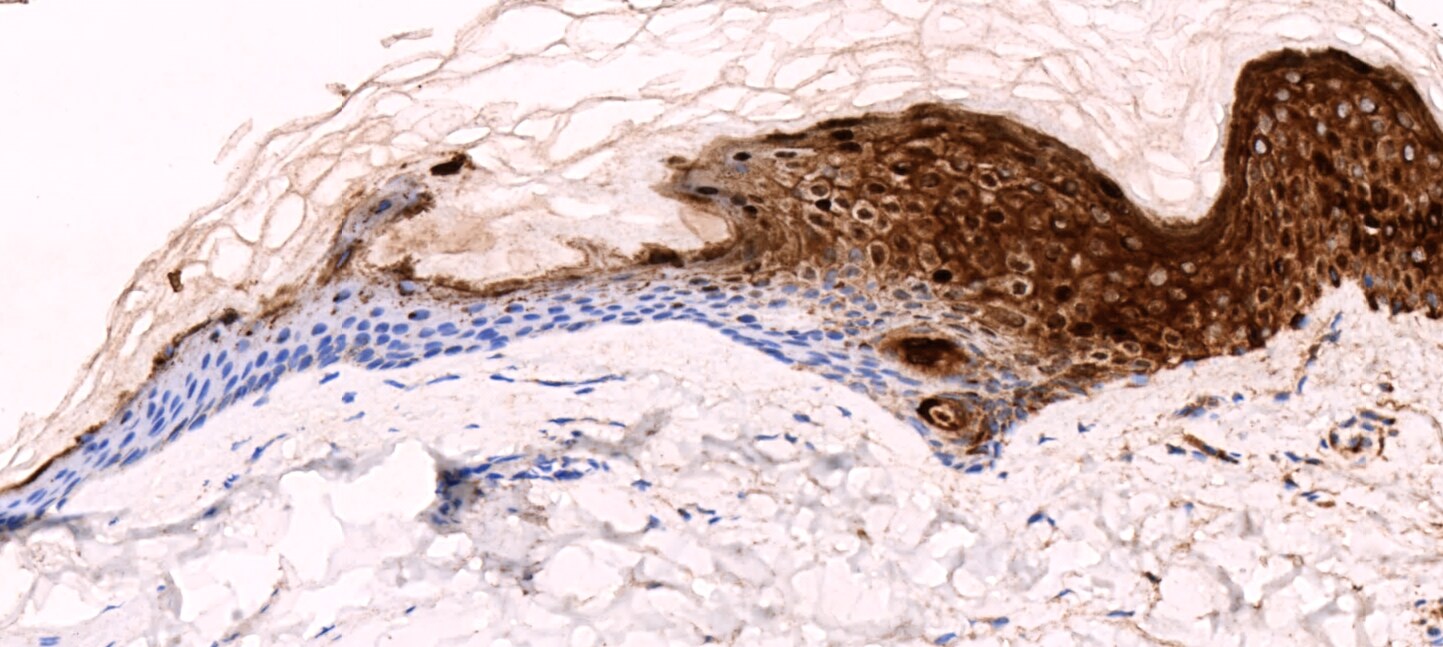 Involucrin Antibody (SY8) - BSA Free NB100-2774