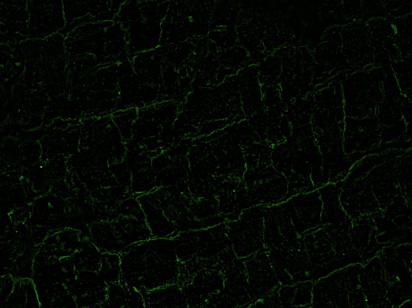 Nitrotyrosine Antibody NB100-2899