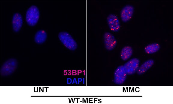 53BP1 Antibody - BSA Free NB100-304
