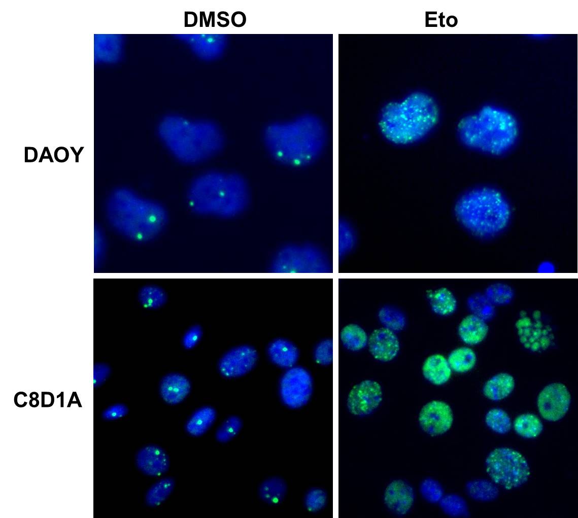 53BP1 Antibody - BSA Free NB100-304