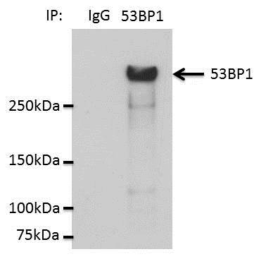 53BP1 Antibody - BSA Free NB100-304