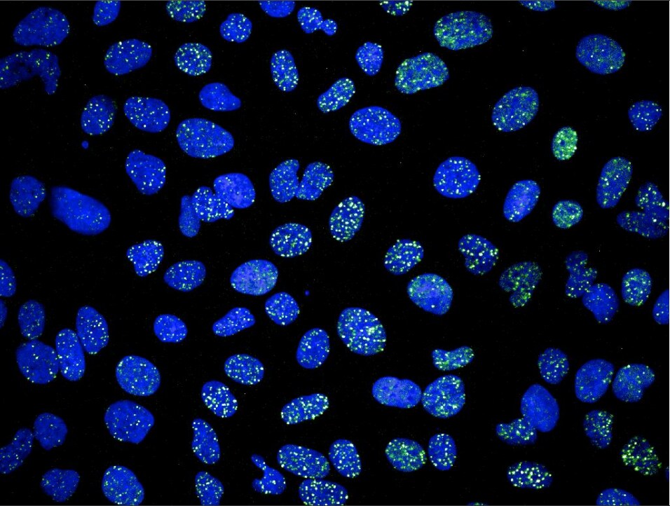 53BP1 Antibody - BSA Free NB100-304