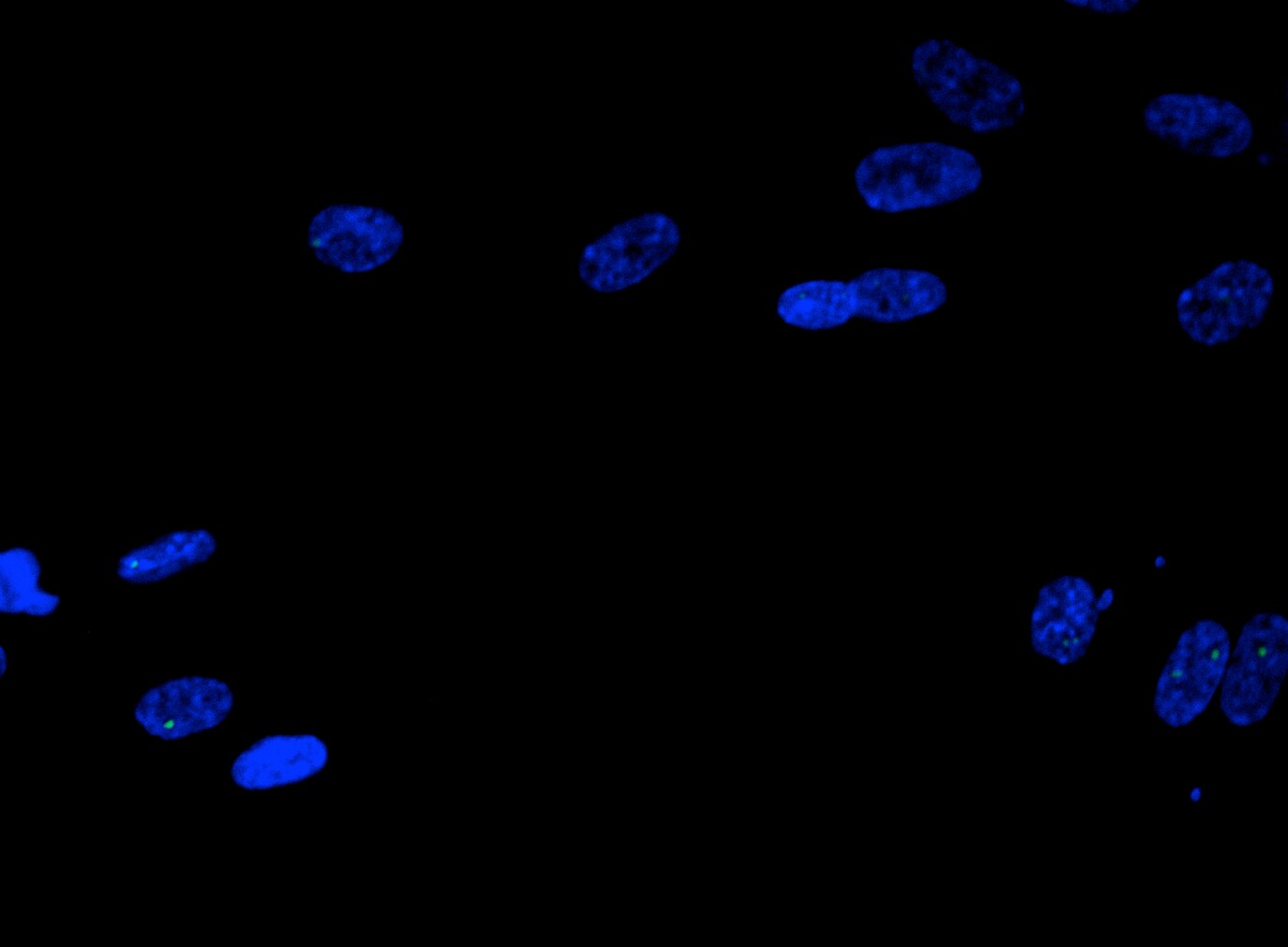 53BP1 Antibody - BSA Free NB100-304