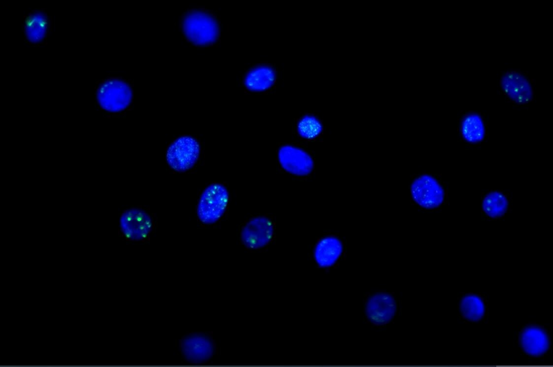 53BP1 Antibody - BSA Free NB100-304