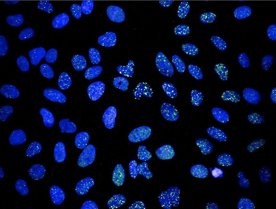 53BP1 Antibody - BSA Free NB100-305