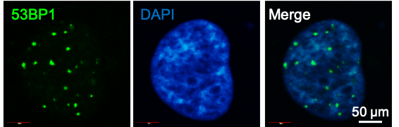53BP1 Antibody - BSA Free NB100-305