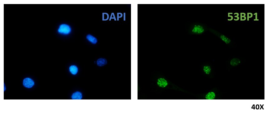 53BP1 Antibody - BSA Free NB100-305
