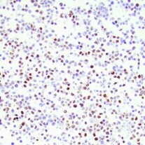 ATM [p Ser1981] Antibody (10H11.E12) - BSA Free NB100-306