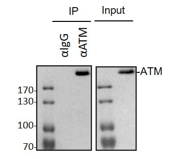 ATM Antibody (2C1) - Azide and BSA Free NB100-309