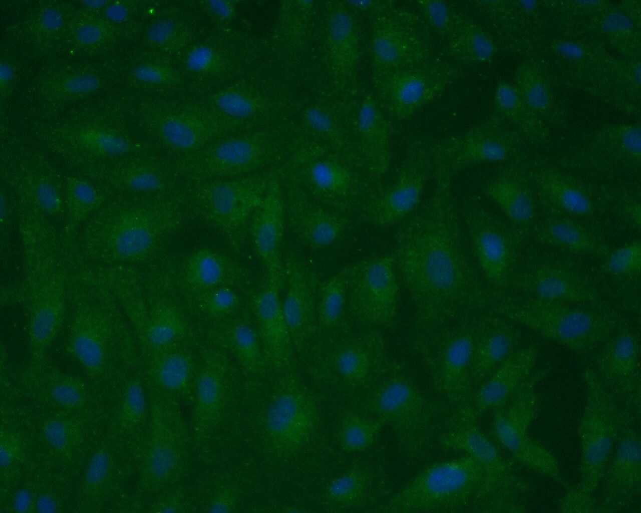 RPE65 Antibody (401.8B11.3D9) - BSA Free NB100-355
