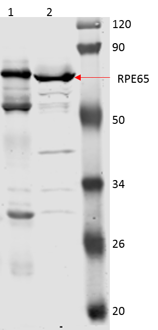 RPE65 Antibody (401.8B11.3D9) - BSA Free NB100-355