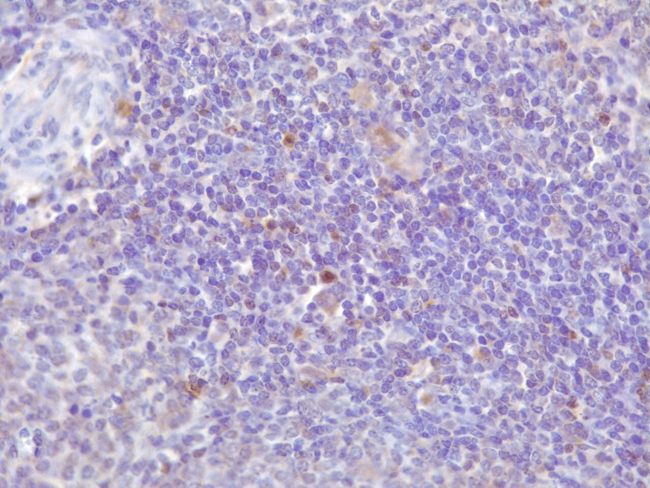 FoxP3 Antibody - BSA Free NB100-39002