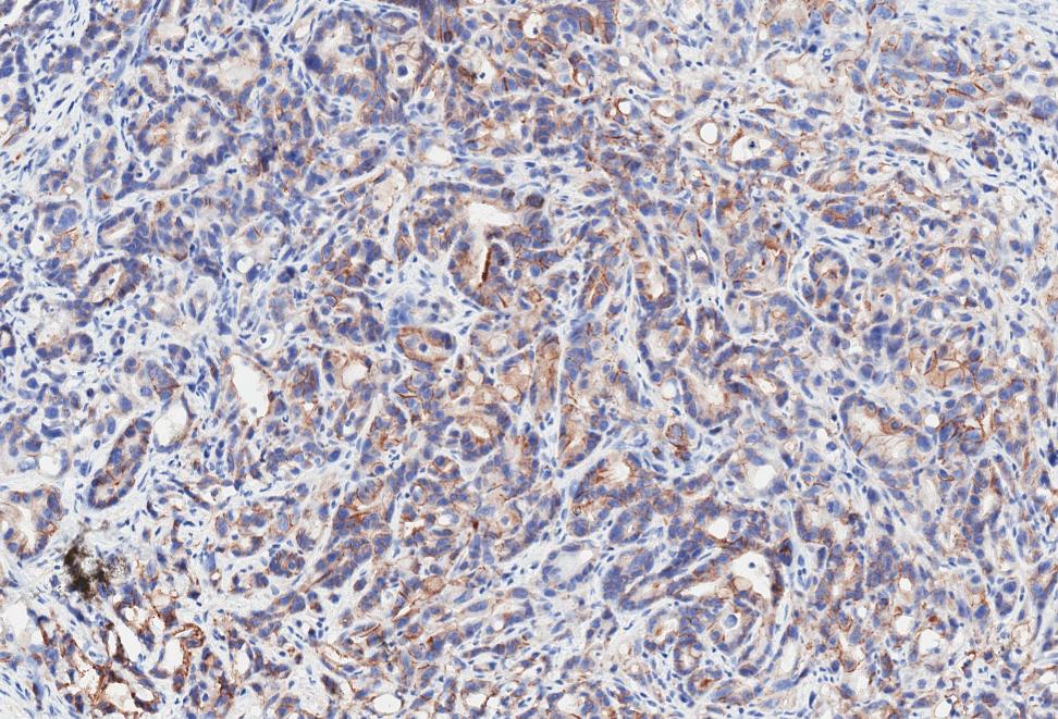 Carbonic Anhydrase IX/CA9 Antibody - BSA Free NB100-417