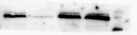 HIF-1 alpha Antibody NB100-449