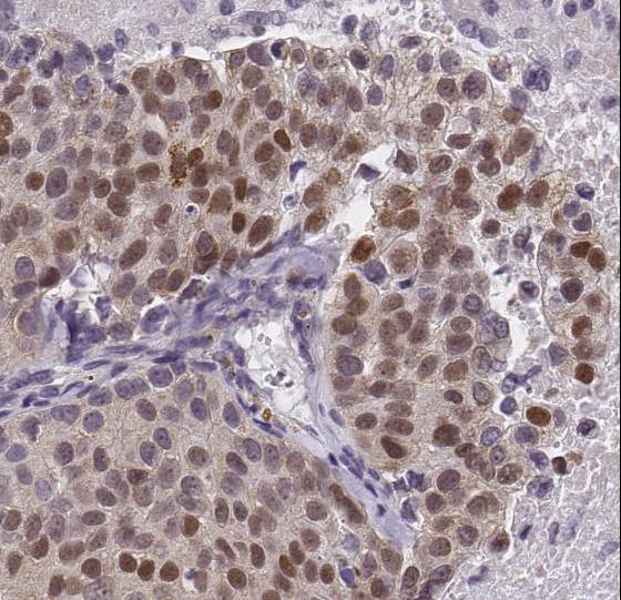 HIF-1 alpha Antibody NB100-449