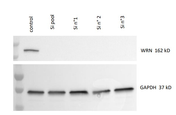 WRN Antibody - BSA Free NB100-471