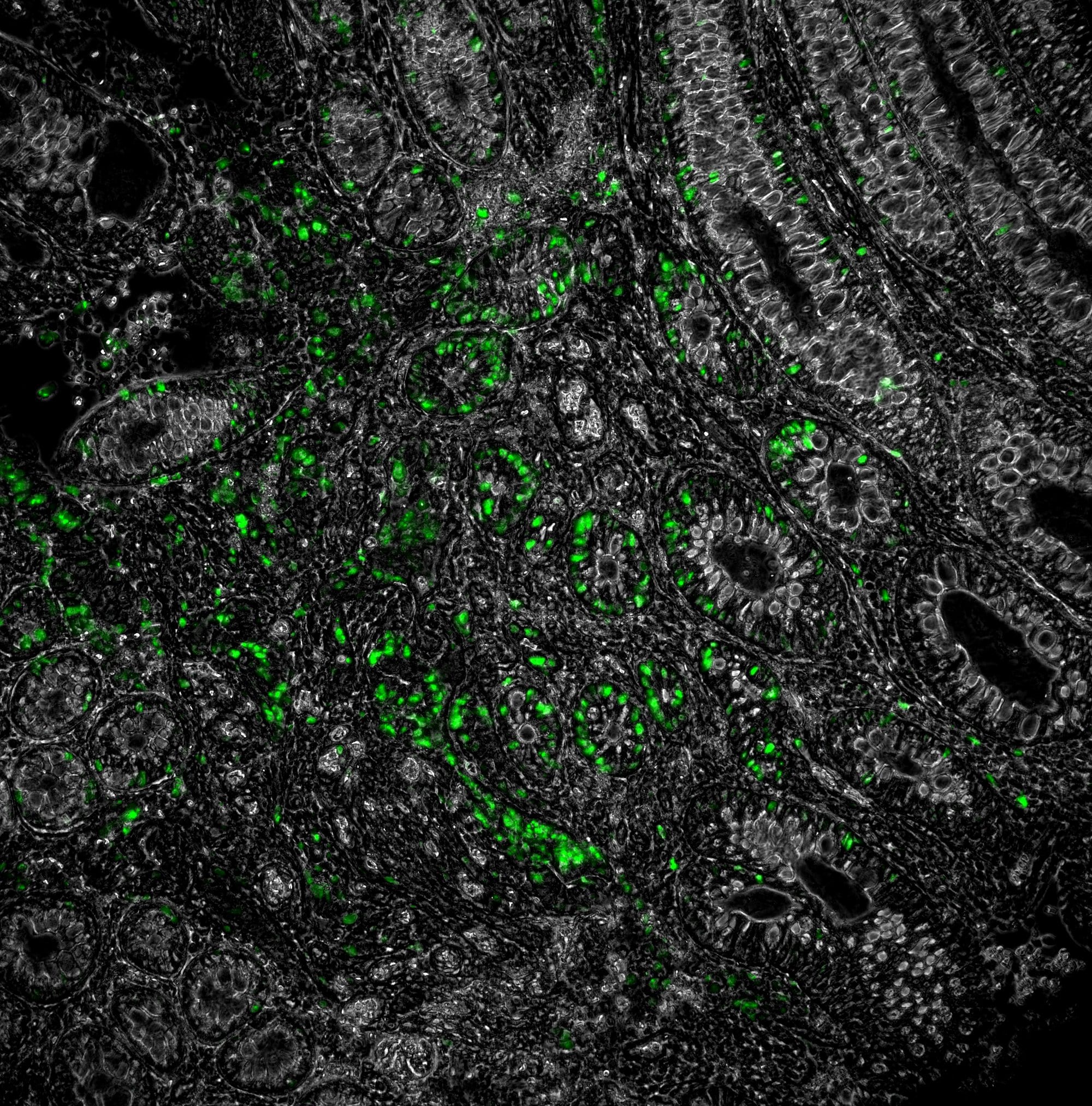 NOD2 Antibody (2D9) [DyLight 488] NB100-524G
