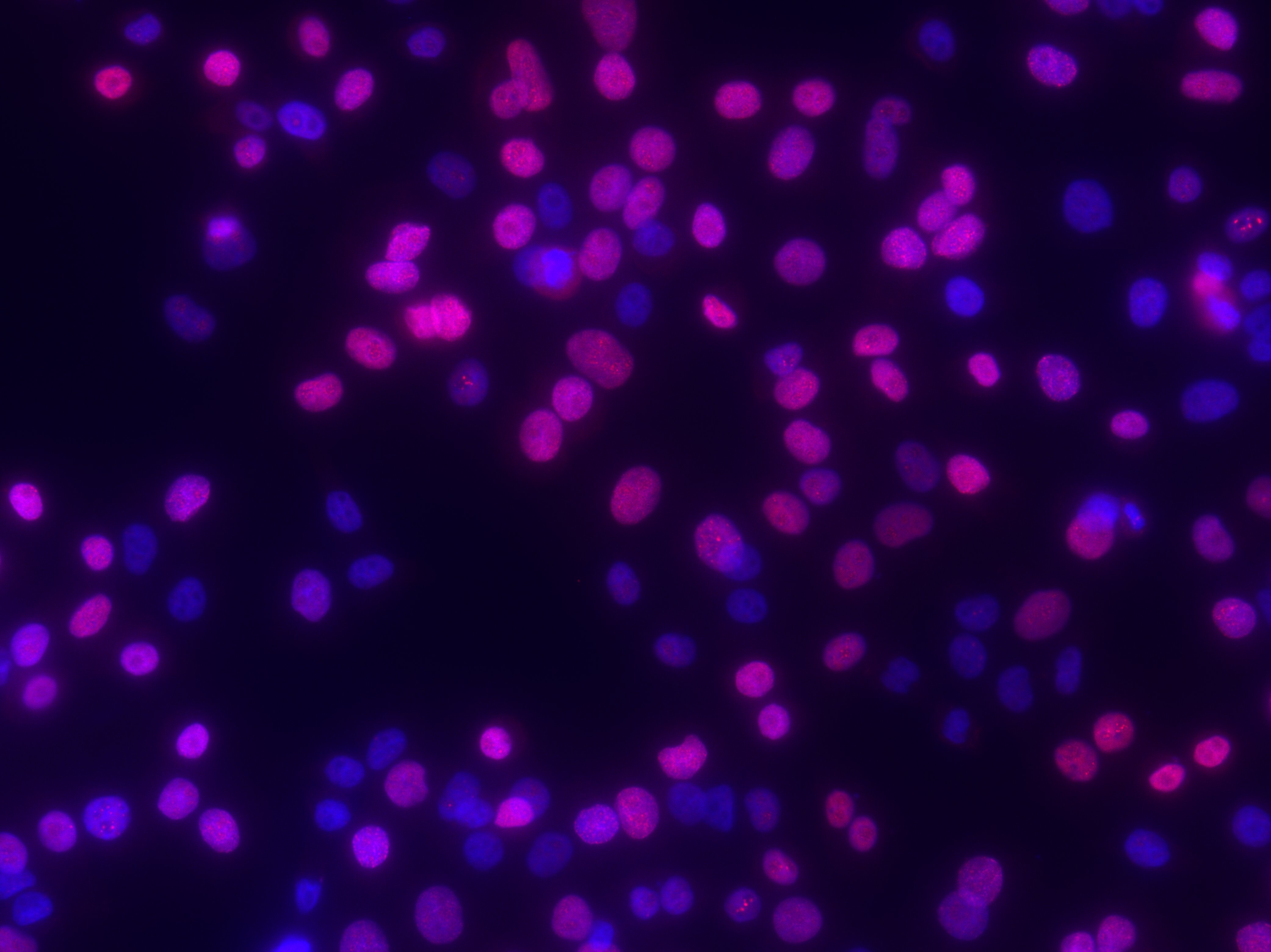 RPA2 [p Ser33] Antibody - BSA Free NB100-544