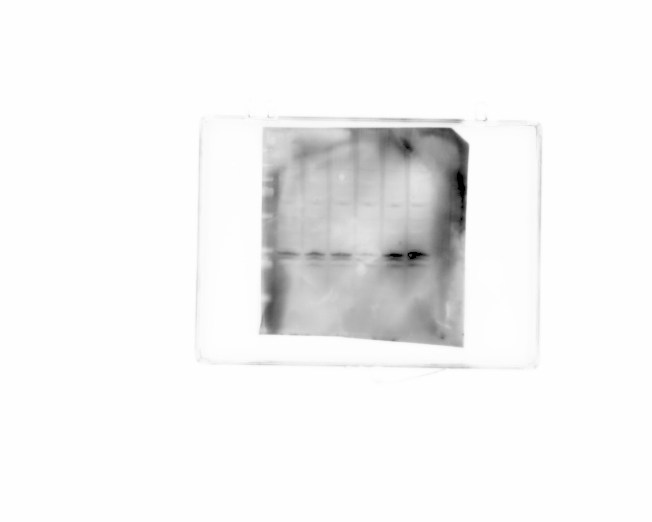 Bcl-2 Antibody - BSA Free NB100-56098
