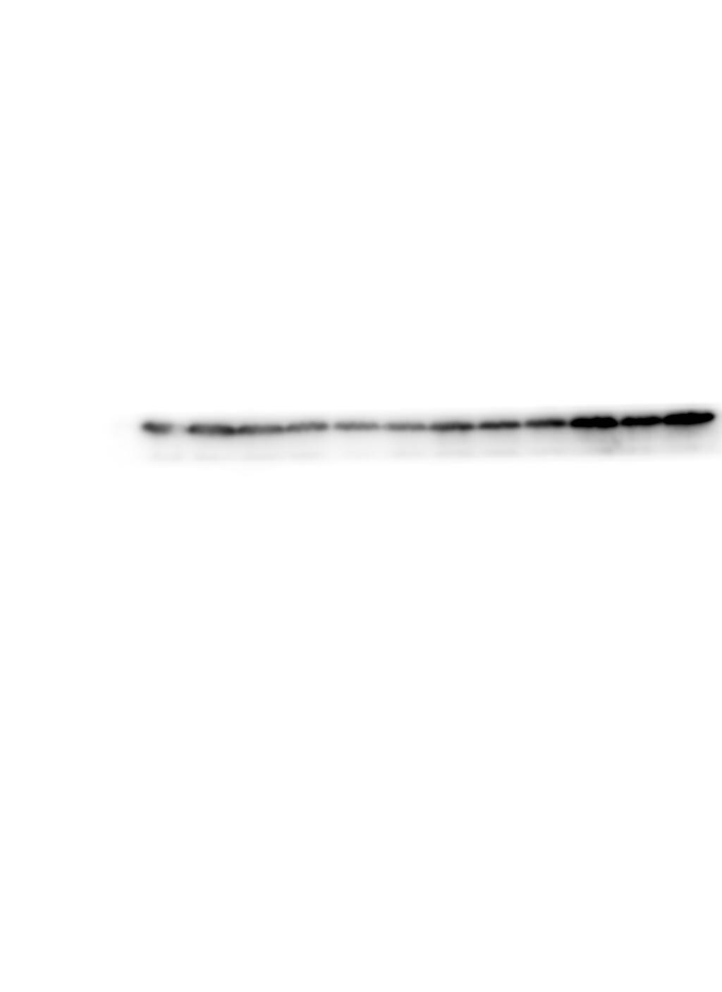 Bcl-2 Antibody - BSA Free NB100-56101