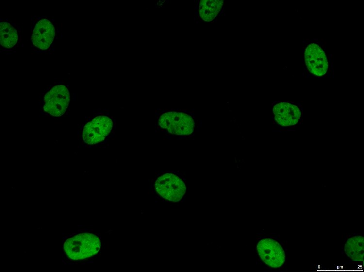 FUS Antibody - BSA Free NB100-561