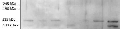 Rictor Antibody - BSA Free NB100-56427