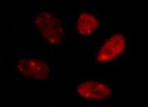 IKK beta Antibody (10AG2) - BSA Free NB100-56509