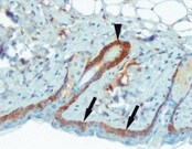 IKK beta Antibody (10A9B6) - BSA Free NB100-56513