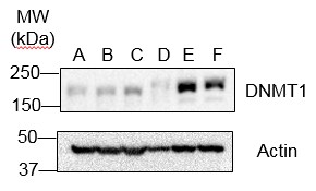 DNMT1 Antibody (60B1220.1) - BSA Free NB100-56519