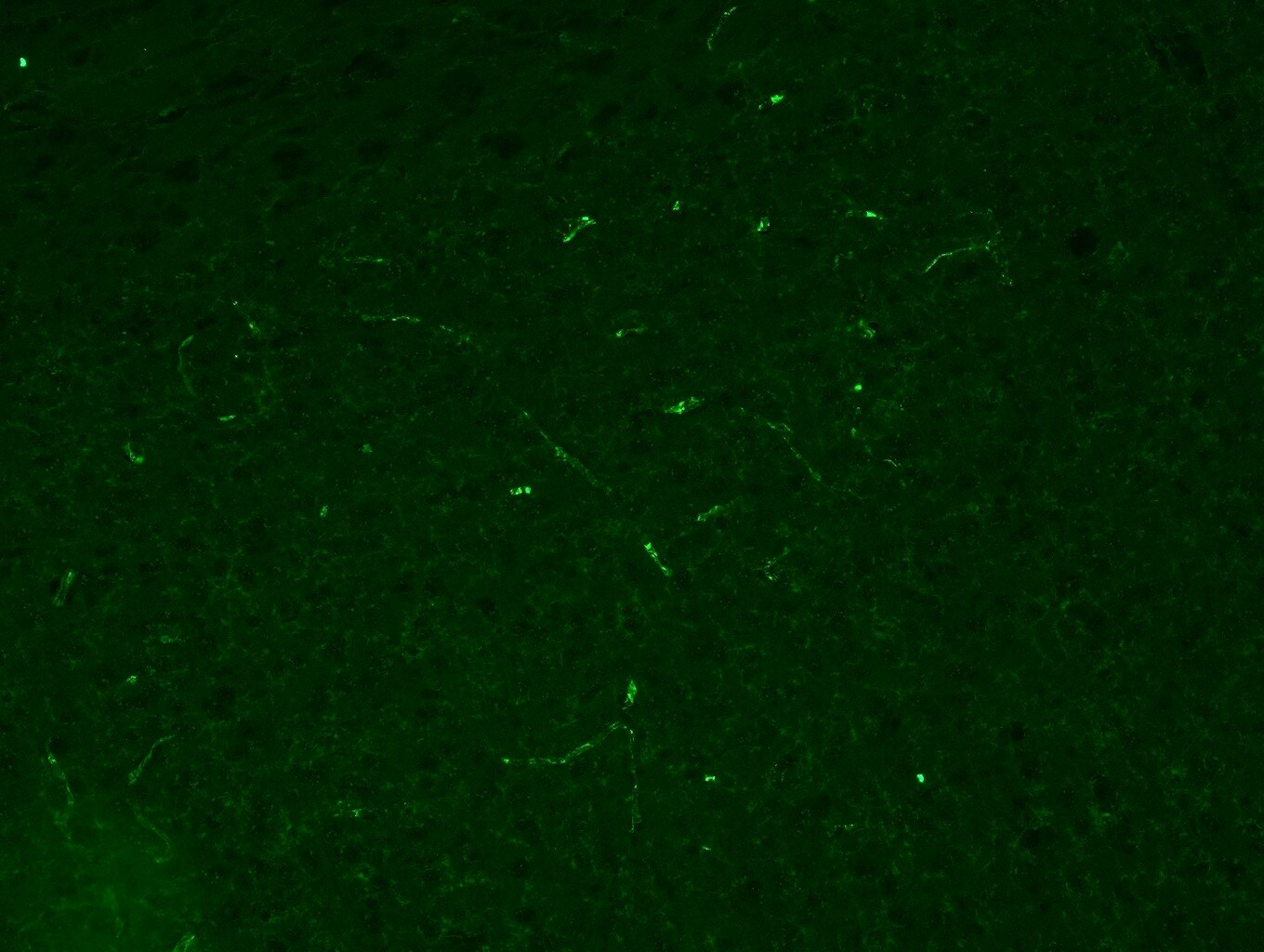 TLR4 Antibody (76B357.1) - BSA Free NB100-56566