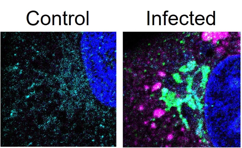 Sars Membrane Protein Antibody - BSA Free NB100-56569
