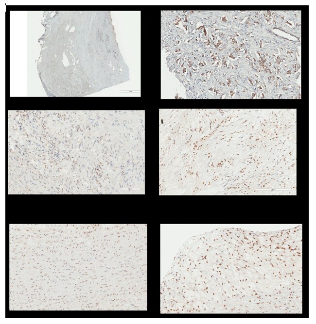 NFkB p105/p50 Antibody (2J10D7) - BSA Free NB100-56583
