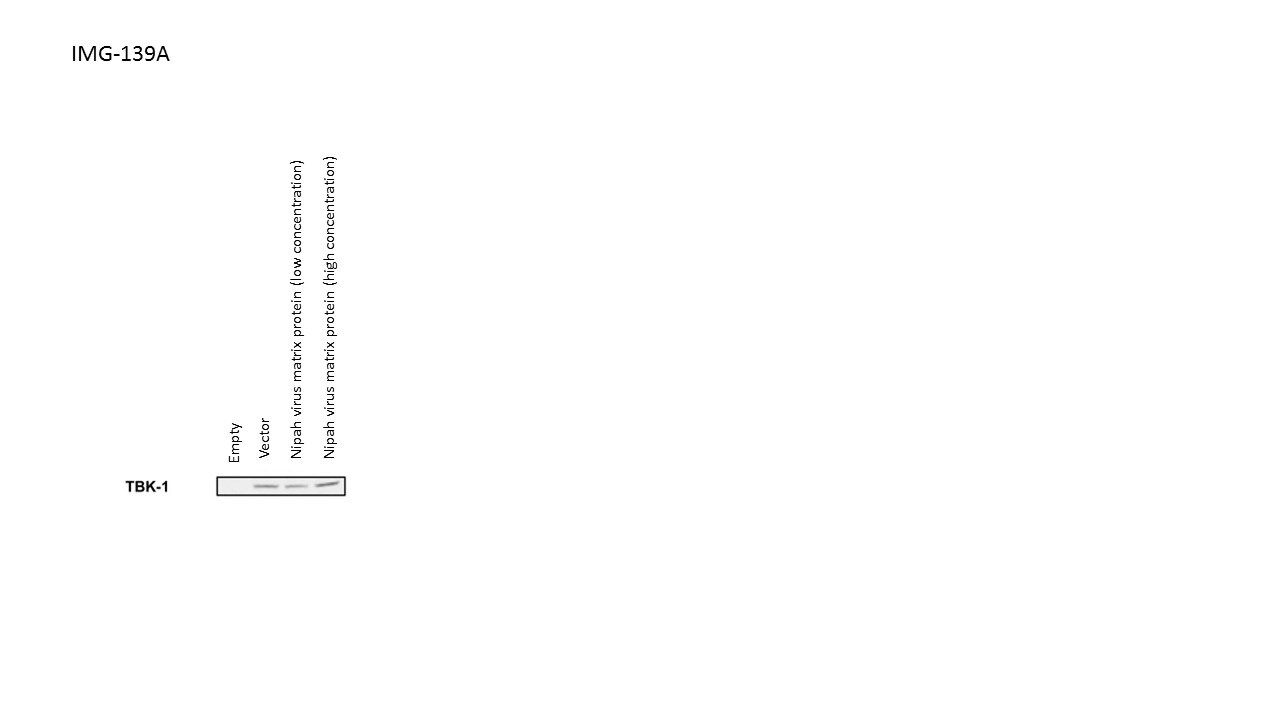TBK1 Antibody (108A429) - BSA Free NB100-56705