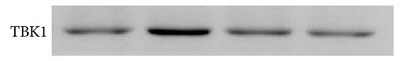 TBK1 Antibody (108A429) - BSA Free NB100-56705
