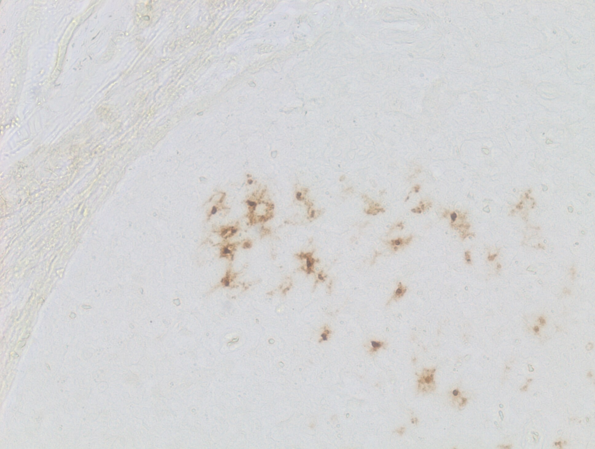 Langerin/CD207 Antibody - BSA Free NB100-56733