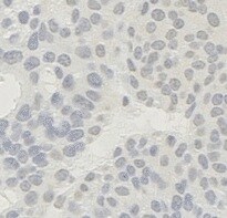 AKT1 [p Ser473] Antibody (104A282) - BSA Free NB100-56749