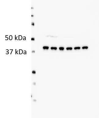 Abhd5 Antibody NB100-57850
