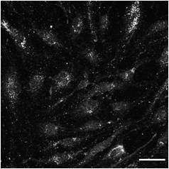 UCP2 Antibody NB100-59742
